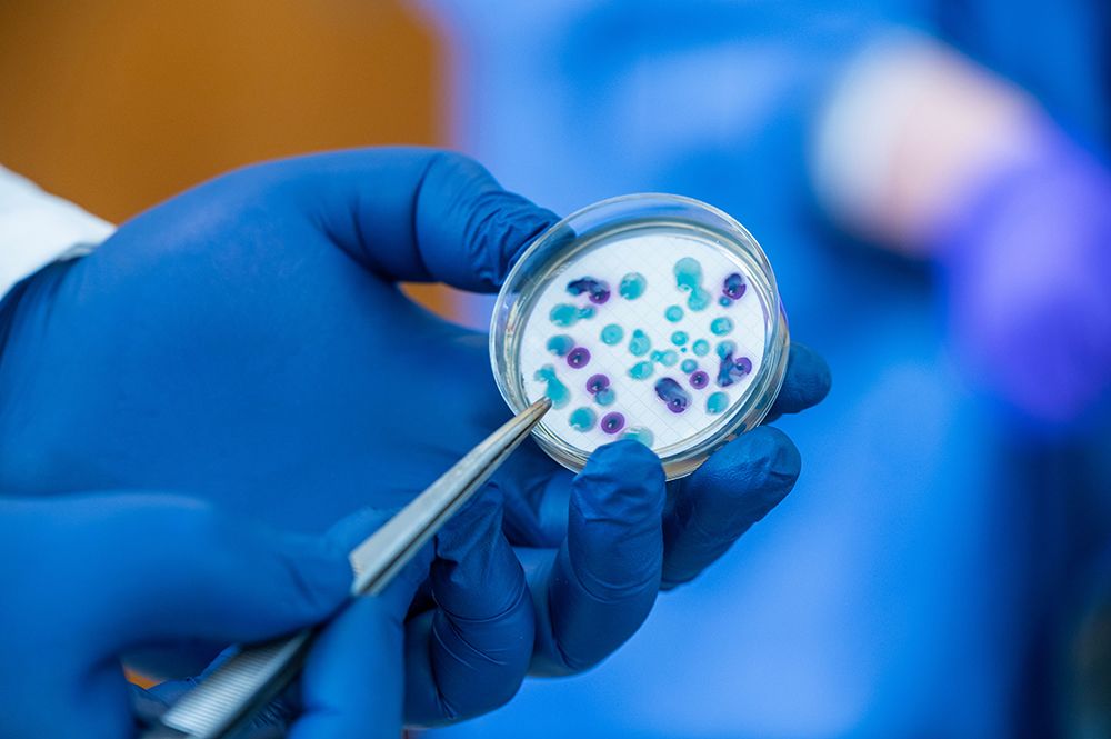 A close up of hands in blue lab gloves holding tweezers and a petri dish containing blue and purple bacteria spots.
