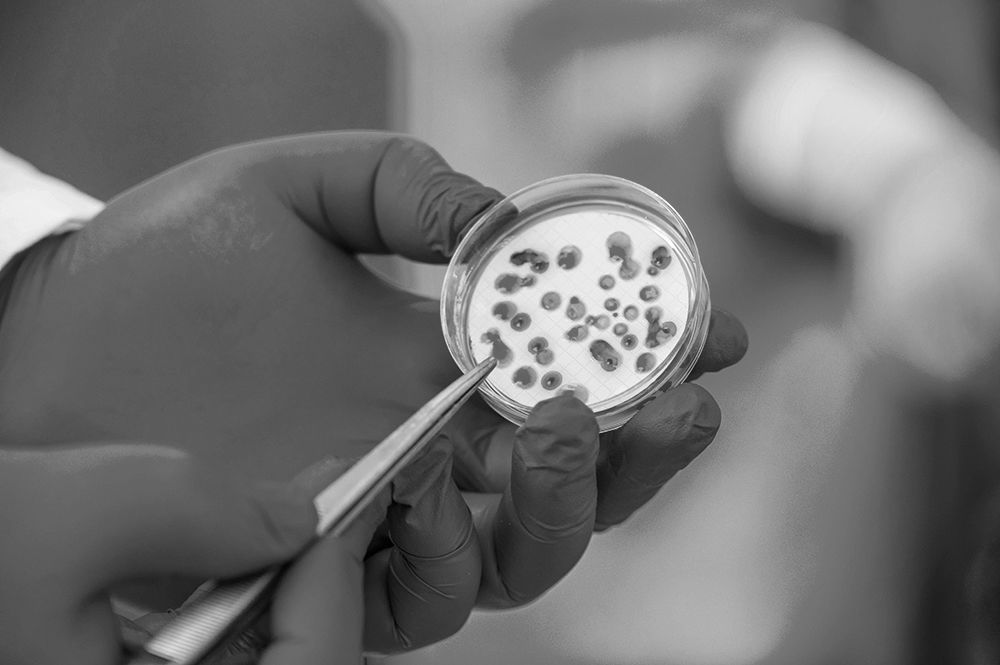 Gloved hands hold tweezers and a petri dish of bacteria spots.